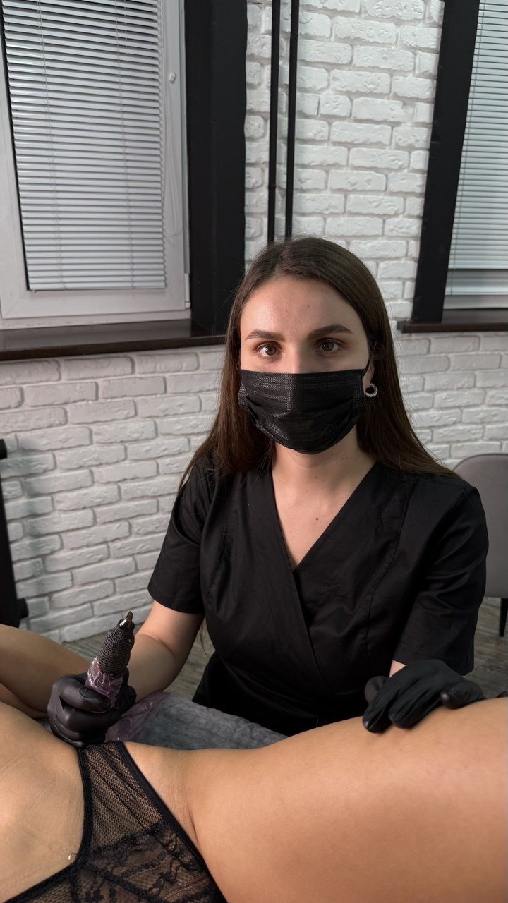 Stretch mark correction procedure